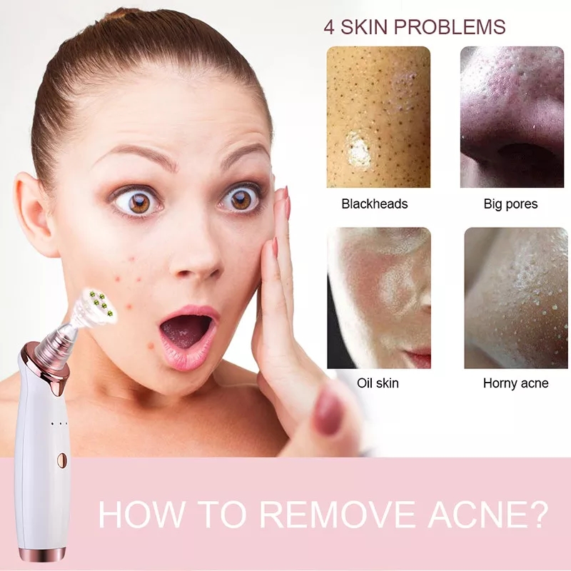 SkinSuction